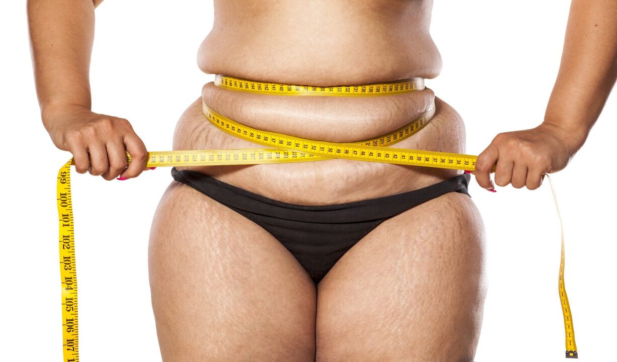 Obesidade e perda de peso usando Keto Probiotix